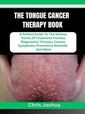 cover image of THE TONGUE CANCER THERAPY BOOK
